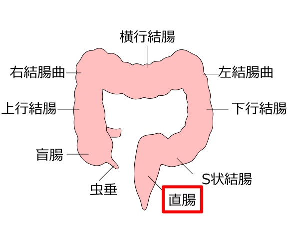 が ん 症状 直腸 大腸が原因の腹痛、大腸癌、直腸癌、大腸検査、大腸ポリープ、血便、総合サイト