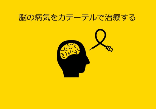 脳神経血管内治療センター