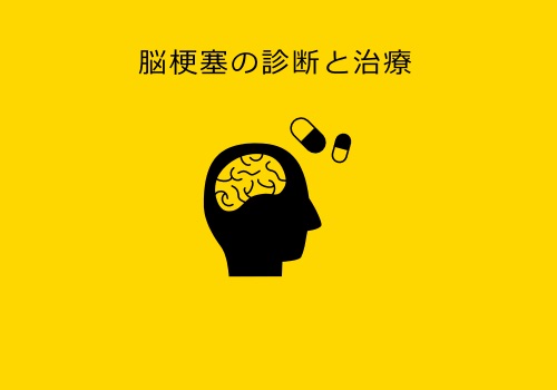 脳梗塞の診断・治療